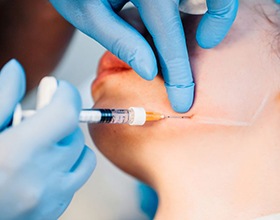 Woman receiving BOTOX injection in her jaw