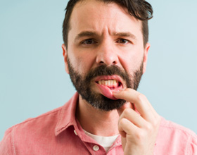 Man pulling down lip to show inflamed gums